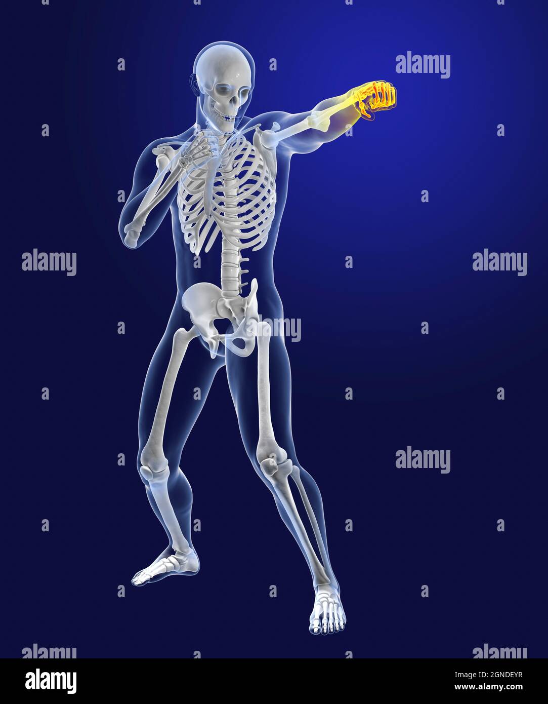 Anatomia di un pugile, illustrazione Foto Stock