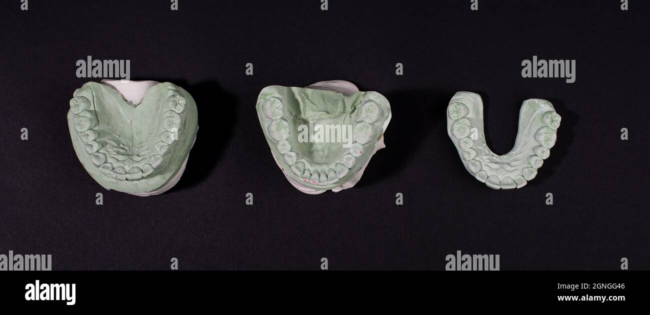 Banner con modelli dentali in gesso di denti umani. Foto Stock