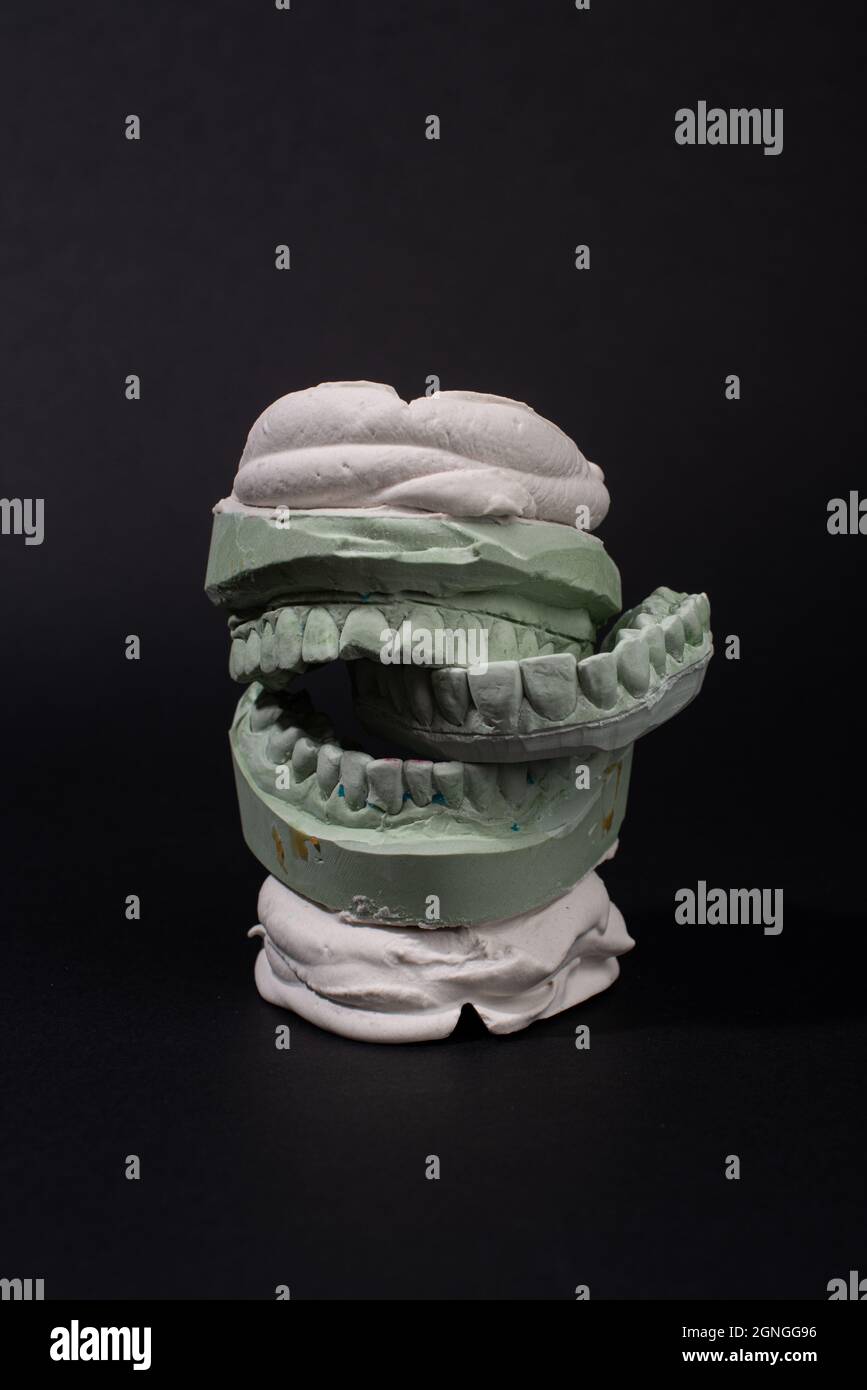 Surreale gesso modello dentario dei denti umani. Foto Stock