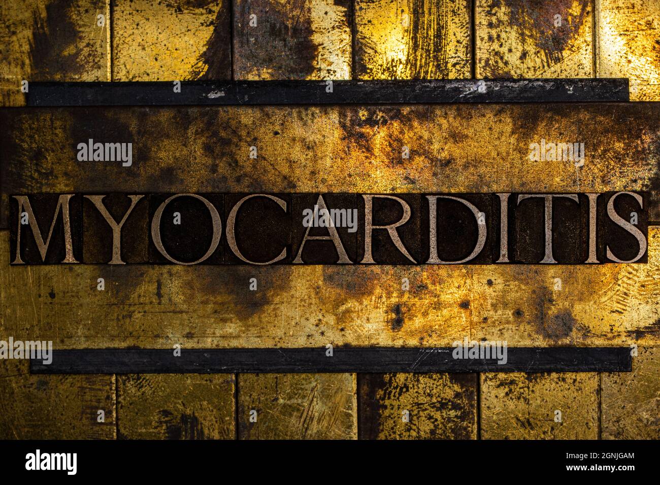Testo della miocardite su fondo in rame grunge testurizzato e oro vintage Foto Stock