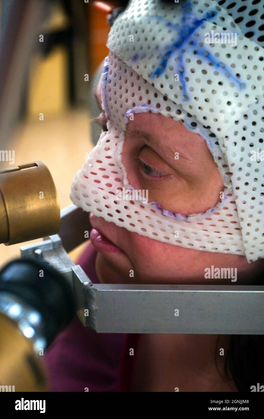 Fascio di Protoni terapia per il trattamento di un carcinoma all'interno dell'occhio. Foto Stock