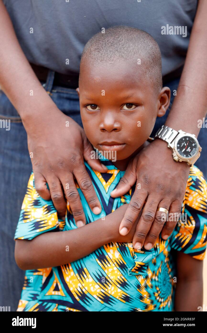 Bambino sponsorizzato da ONG francese : la Chaine de l'Espoir. ( catena della speranza ). Benin. Foto Stock