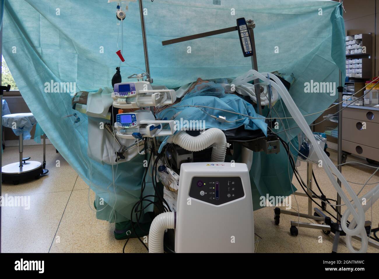 un paziente è ventilato sotto anestesia generale su un tavolo operatorio Foto Stock