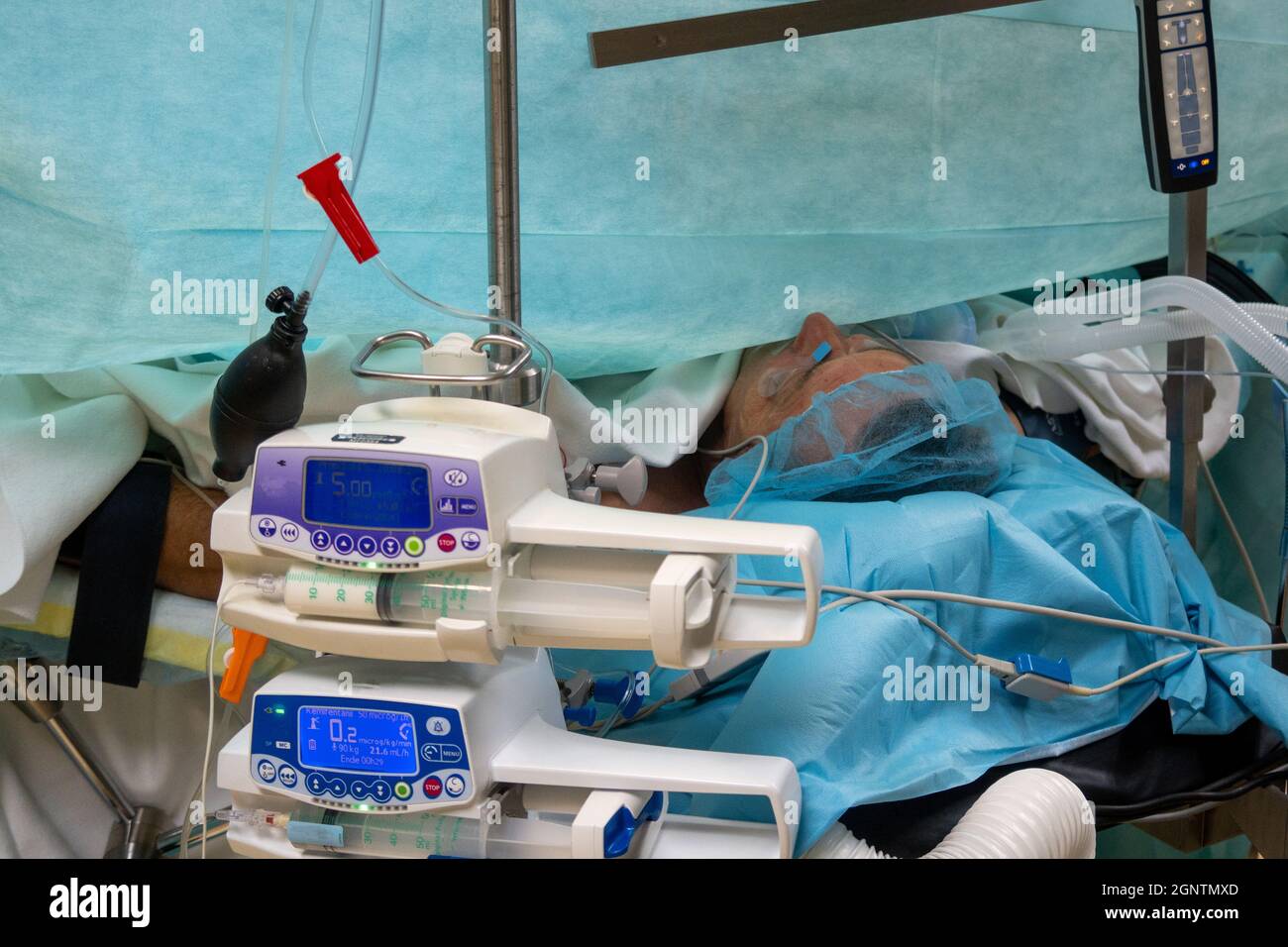 un paziente è ventilato sotto anestesia generale su un tavolo operatorio Foto Stock