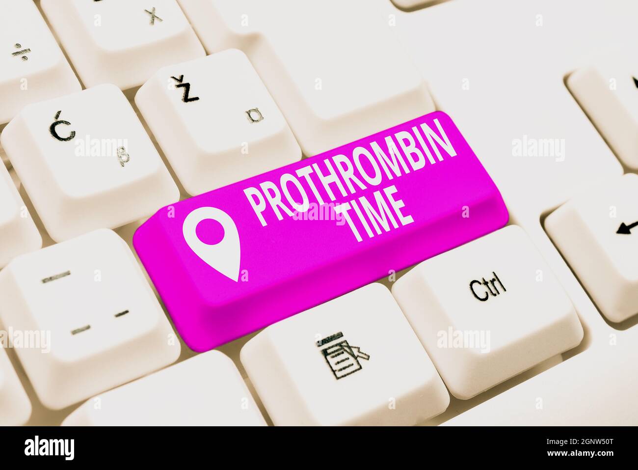 Didascalia concettuale tempo di protrombina. Approccio aziendale valutare la vostra capacità di formare adeguatamente coaguli di sangue creando nuovo Online Shop Business Foto Stock