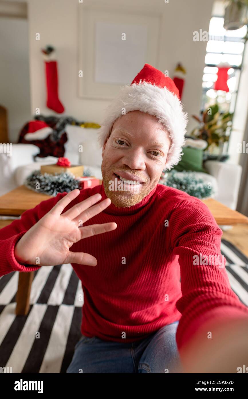 Albino african american uomo che indossa santa Hat fare videochiamata con decorazioni di natale Foto Stock