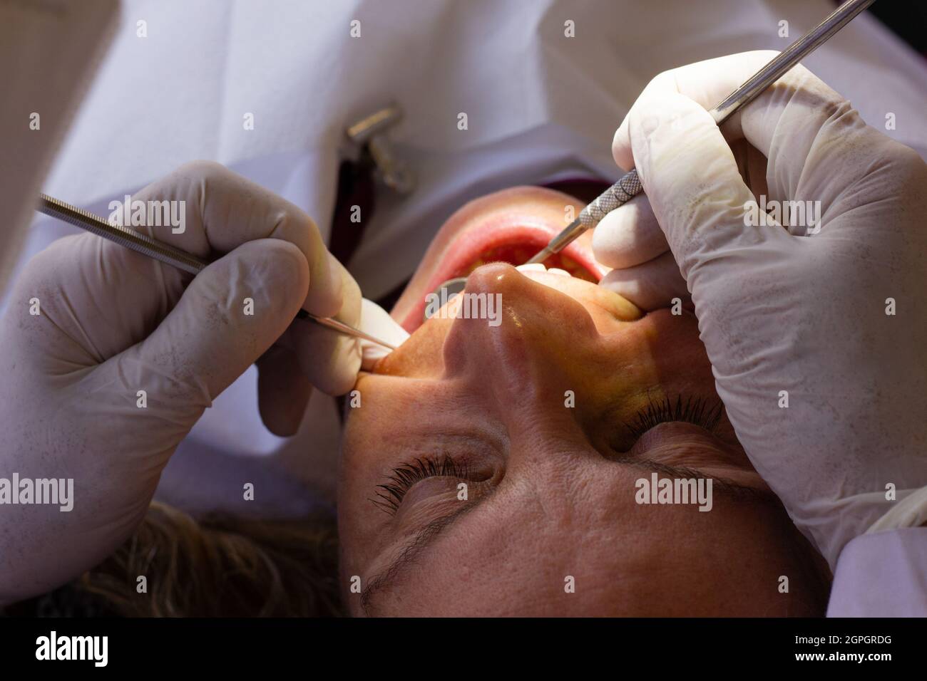 Dentista con guanti in lattice con strumenti ortodontici che controllano i denti della paziente con bocca aperta. Cura orale, concetti di trattamento clinico dentale Foto Stock
