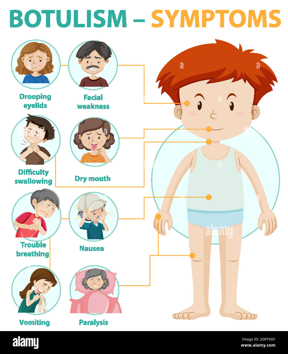 Infografica informativa sui sintomi botulistici Illustrazione Vettoriale