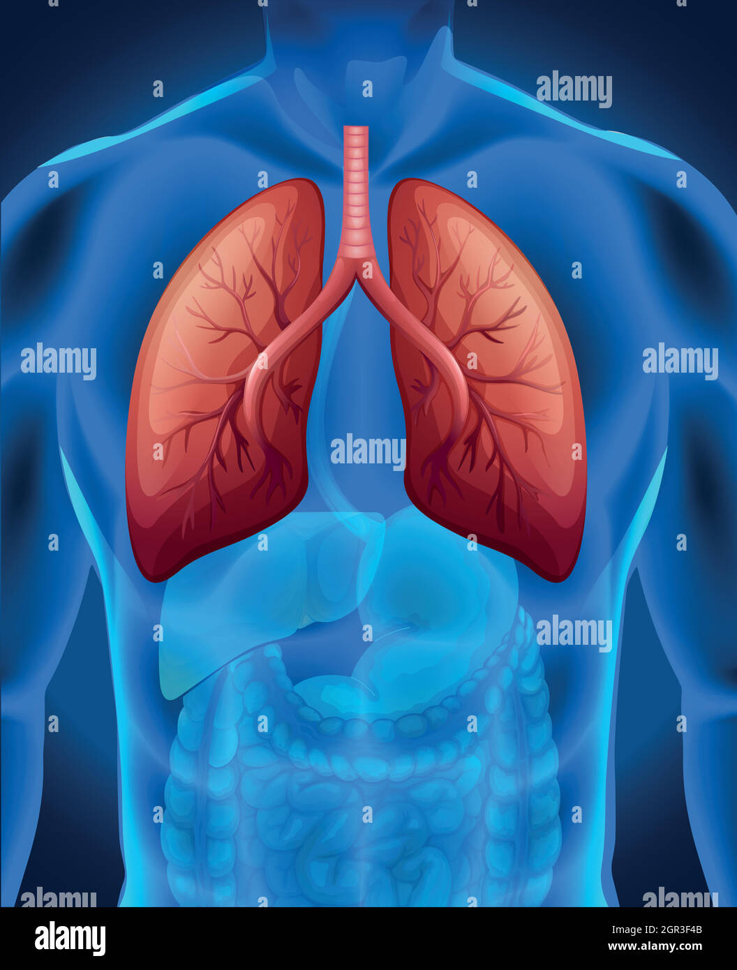 Cancro polmonare nell'uomo Illustrazione Vettoriale