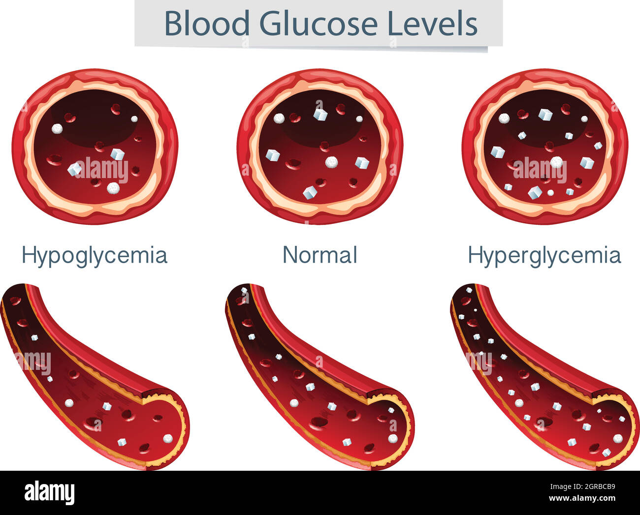 3 diversi livelli di glucosio nel sangue Illustrazione Vettoriale