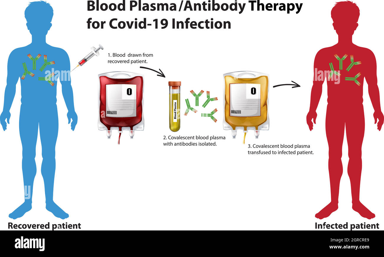 Infografica sulla terapia plasmatica/anticorpale del sangue per l'infezione da Covid-19 Illustrazione Vettoriale