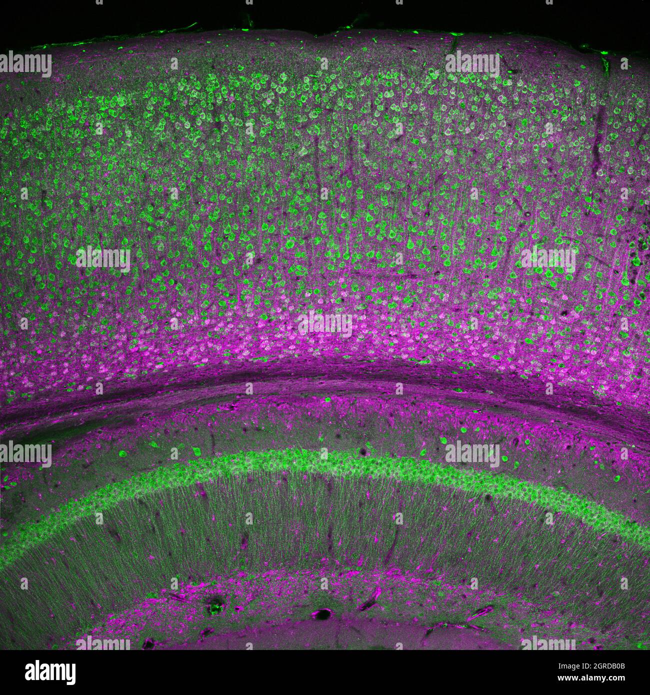 Corteccia cerebrale e parte dell'ippocampo sotto di essa in una sezione di un cervello di topo, marcato con immunofluorescenza e registrato con laser confocale Foto Stock
