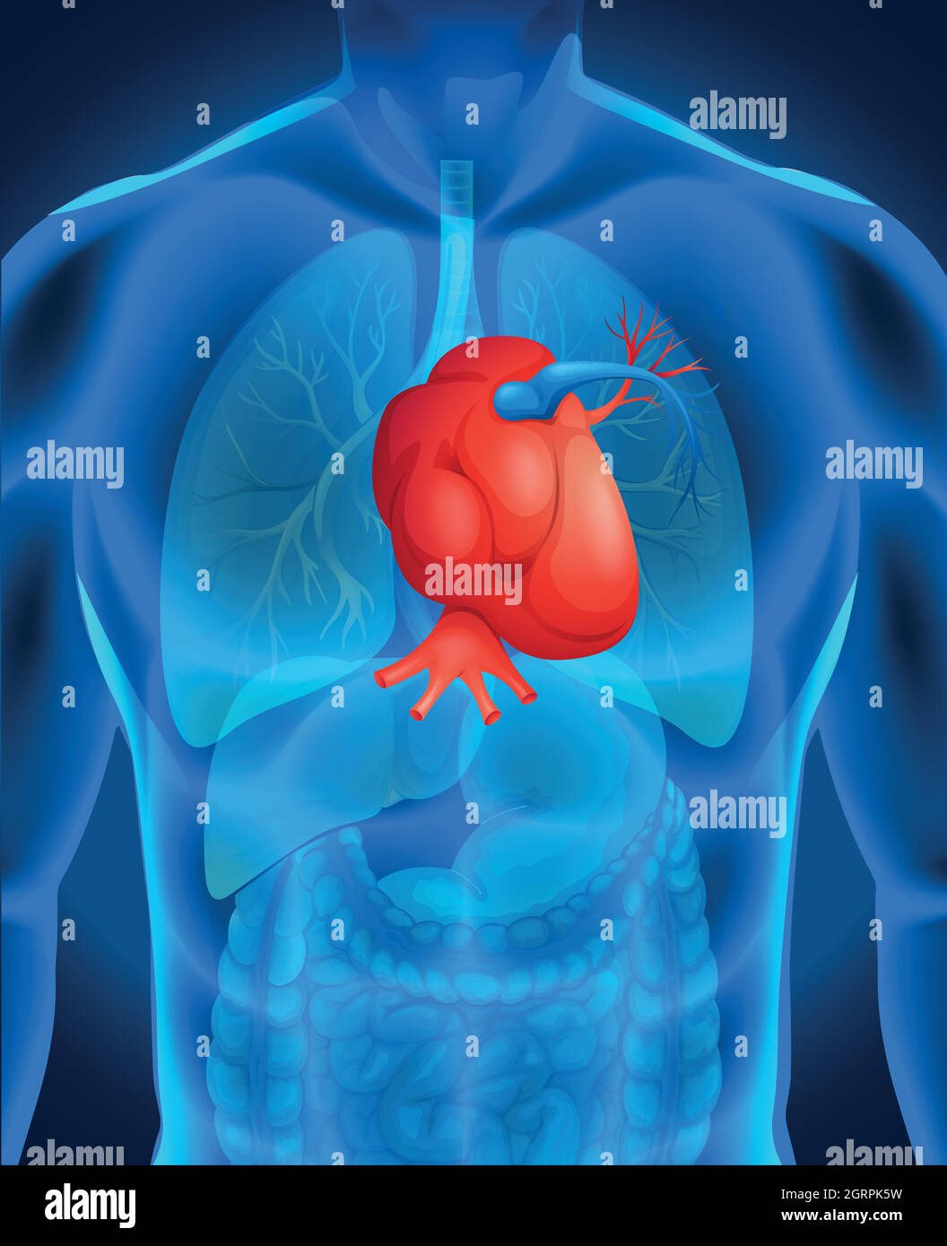 Diagramma di malattia di cuore nell'uomo Illustrazione Vettoriale