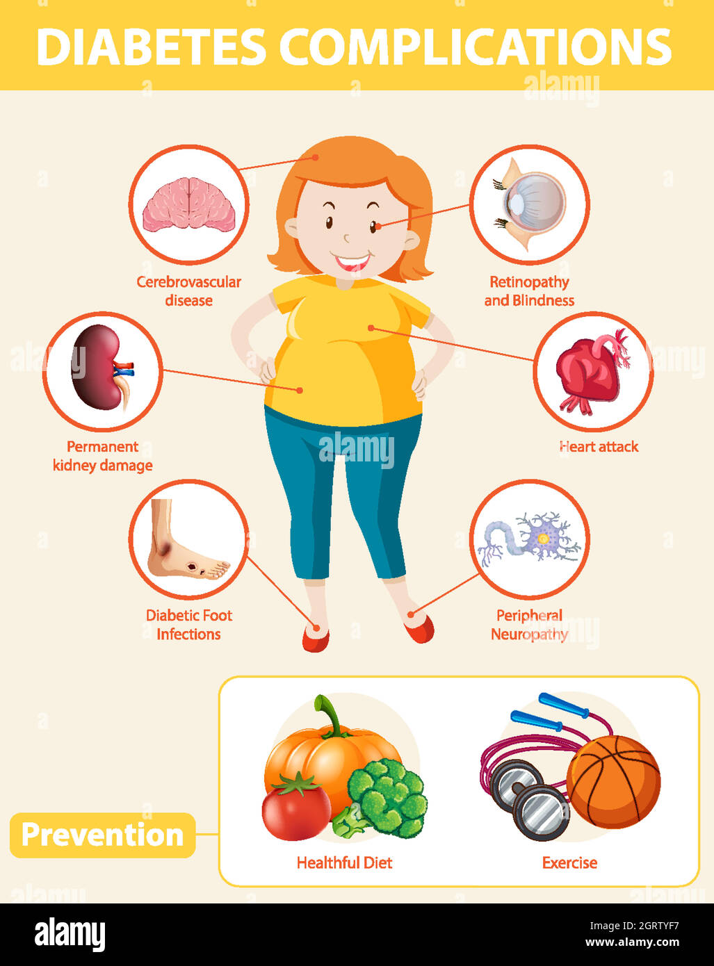Infografica medica delle complicazioni e delle prevenzioni del diabete Illustrazione Vettoriale