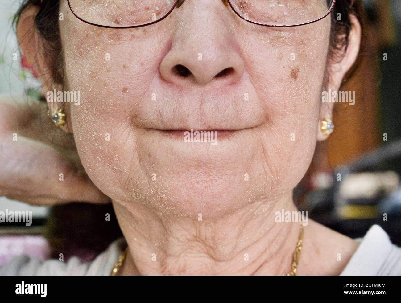 Invecchiamento della pelle pieghe o pieghe della pelle o rughe al collo del sud-est asiatico, vecchia donna cinese. Foto Stock