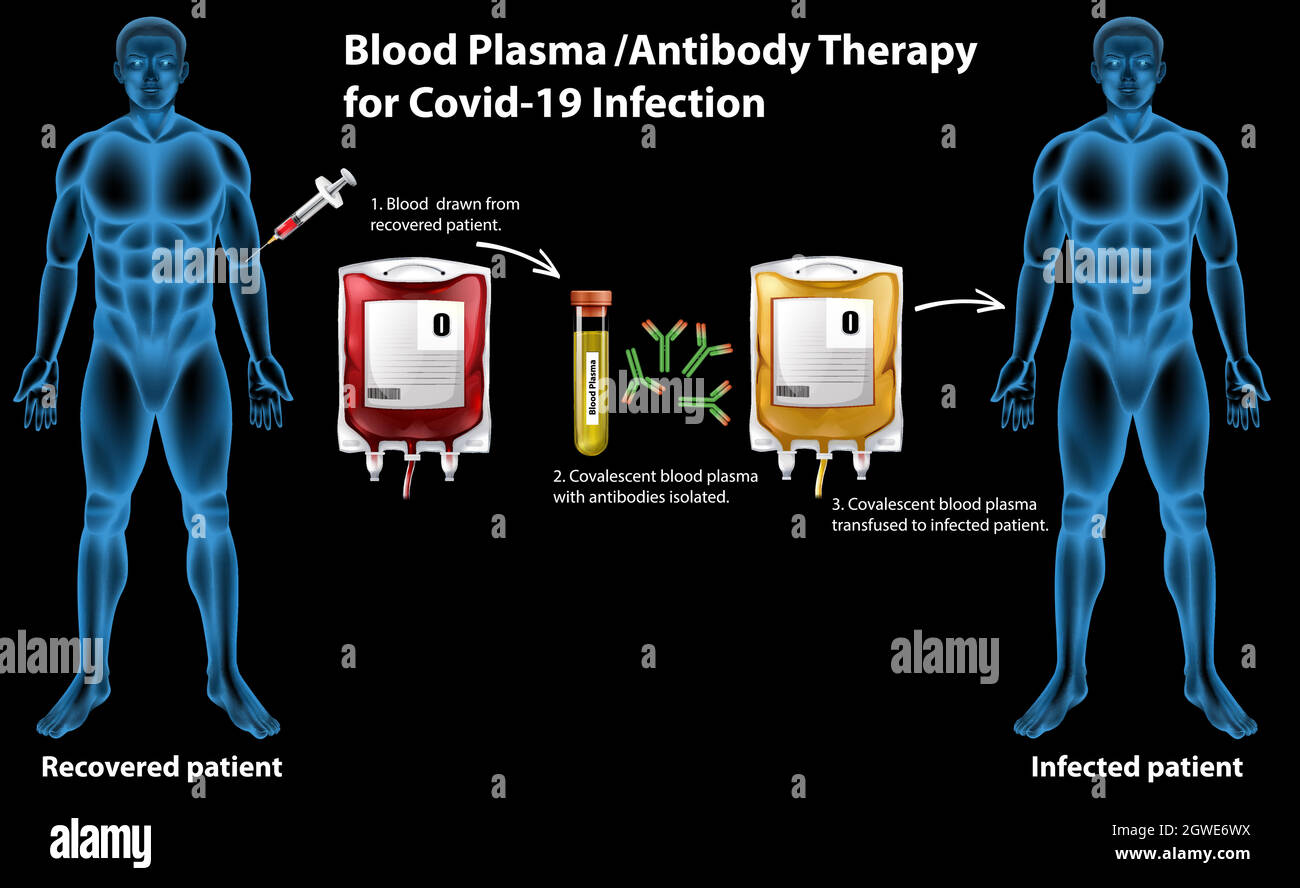 Infografica sulla terapia plasmatica/anticorpale del sangue per l'infezione da Covid-19 Illustrazione Vettoriale