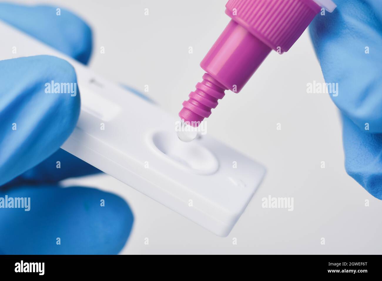 Posizionare manualmente il campione per le secrezioni nel kit SARS COV-2 Rapid Antigen Test (ATK) con la provetta di estrazione, Coronavirus Infectious Protective Concept Foto Stock