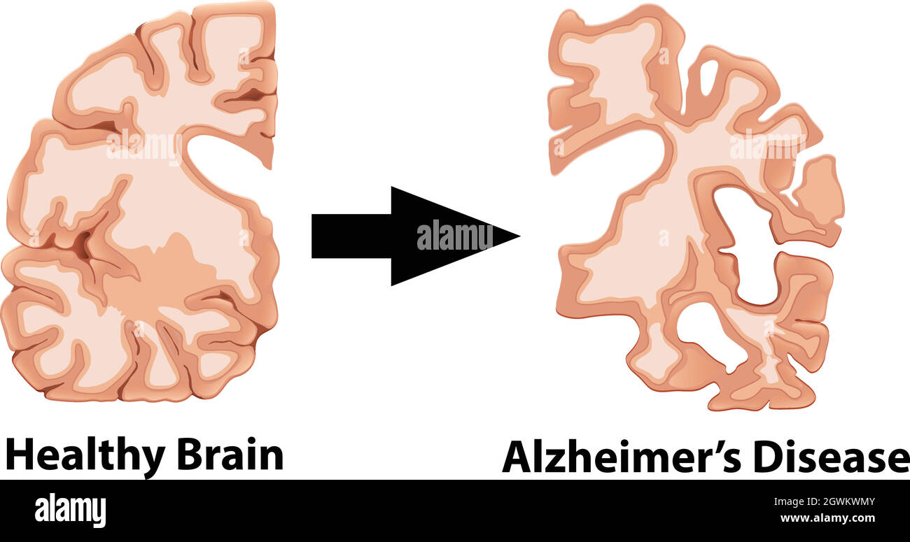 Un'anatomia umana del cervello Illustrazione Vettoriale