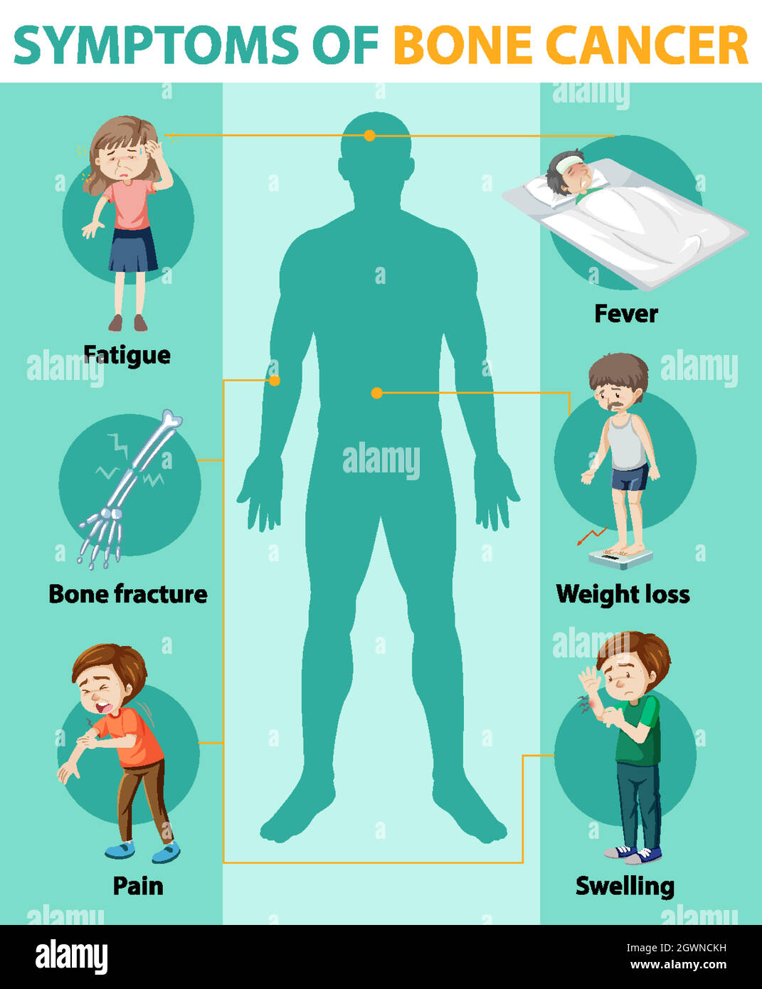 Infografica medica del cancro dell'osso Illustrazione Vettoriale