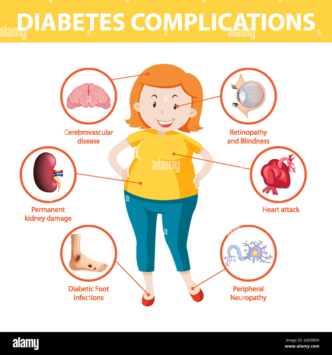 Infografica sulle complicanze del diabete Illustrazione Vettoriale