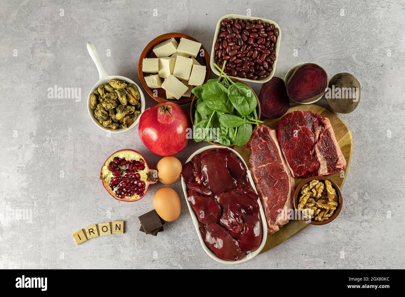 Alimenti ad alto contenuto di ferro, comprese uova, noci, spinaci, fagioli, tofu, fegato, manzo, barbabietola, cozze, e cioccolato fondente. Foto Stock