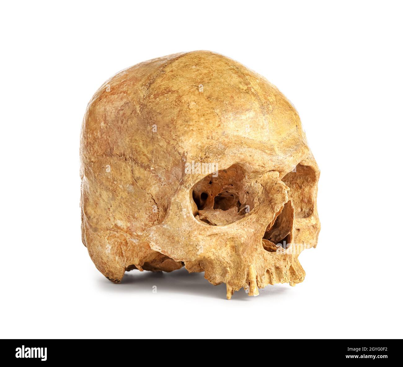 Cranio umano su sfondo bianco Foto Stock