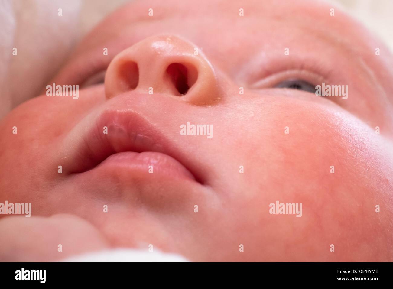 Labbra rosa di bambina con callo a causa di un forte riflesso succhiante Foto Stock