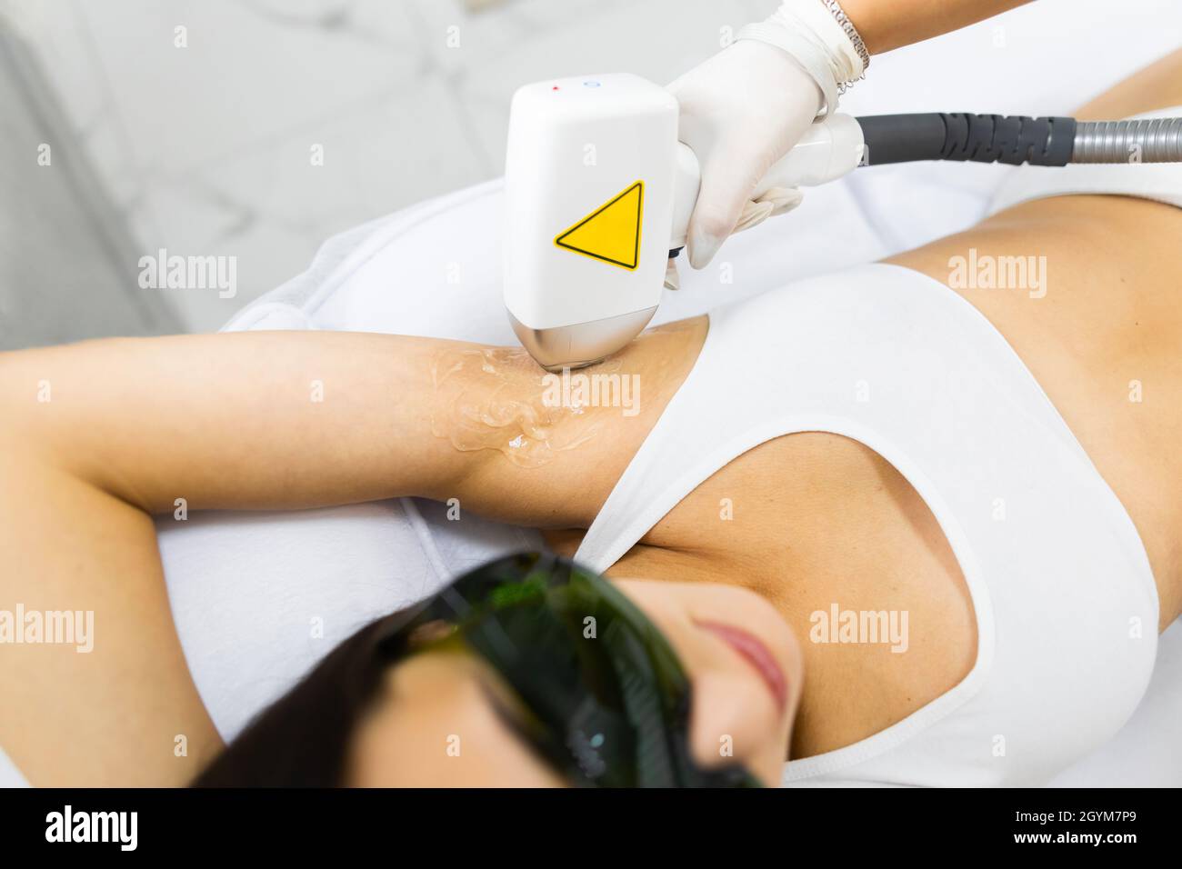 La donna ha i capelli dell'ascella rimossi con un laser Foto Stock