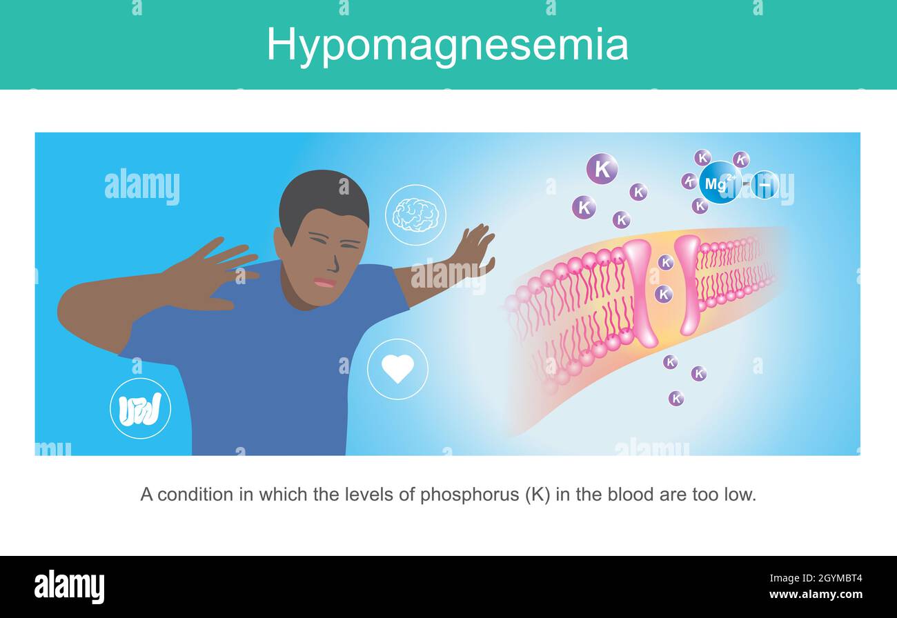 IPOMAGNESEMIA. Illustrazione per mostrare i sintomi una condizione dell'uomo in cui i livelli di fosforo nel sangue sono troppo bassi. Illustrazione Vettoriale