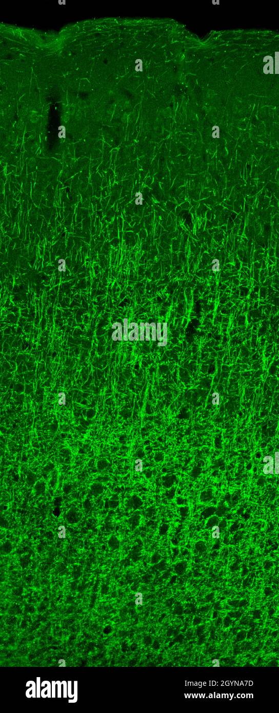 Sezione di corteccia cerebrale murina, con oligodendrociti marcati con immunofluorescenza e visualizzati con un microscopio a scansione laser confocale Foto Stock