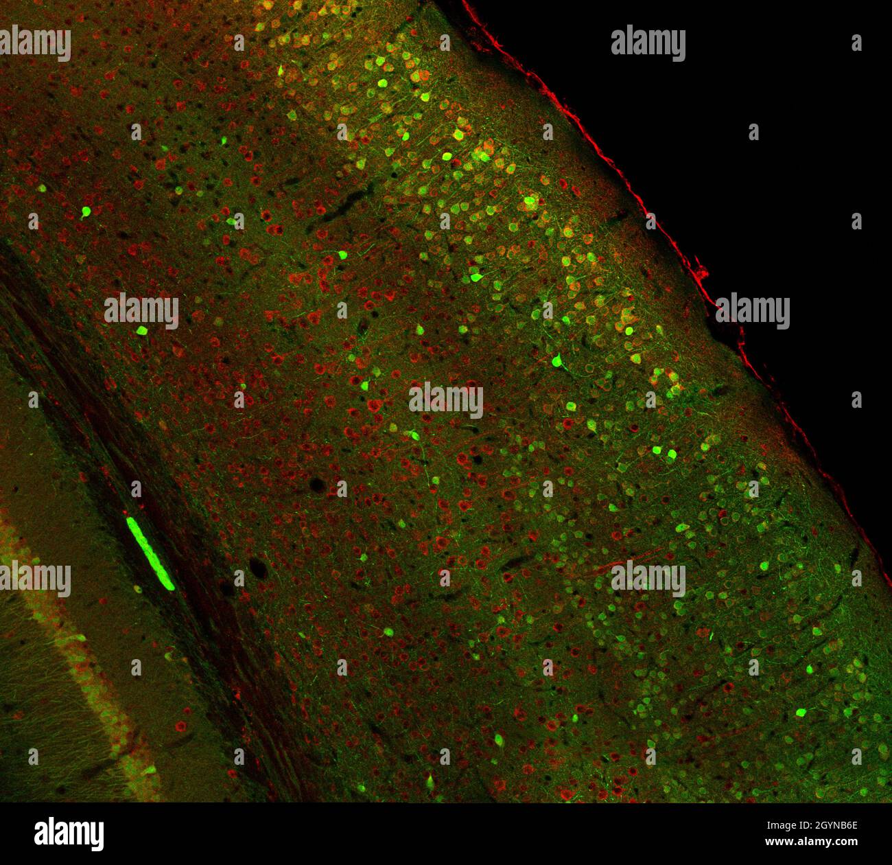 Immagine in microscopia a scansione laser confocale di cellule marcate con immunofluorescenza nella corteccia cerebrale del cervello del topo Foto Stock