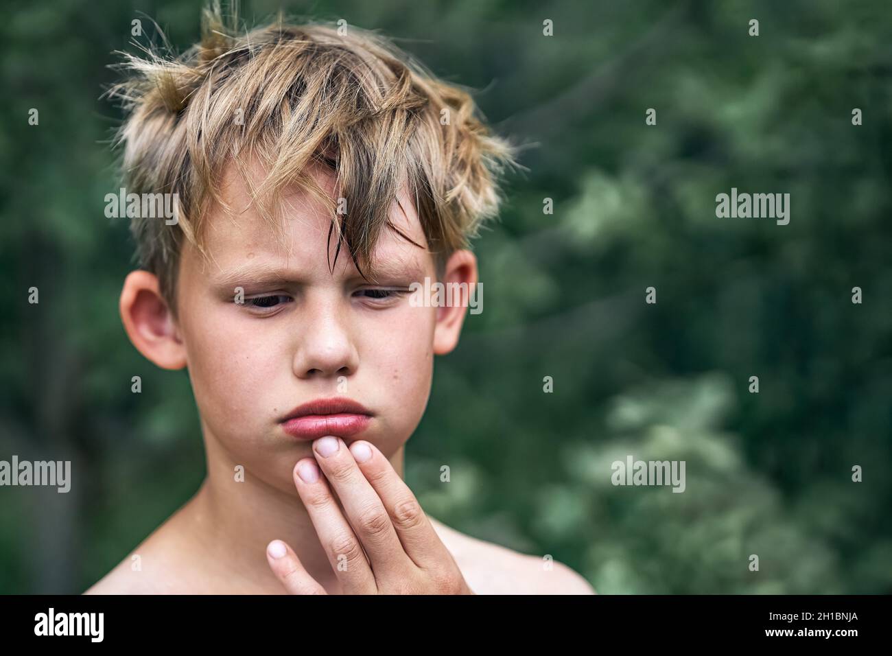 Ragazzo sconvolto con capelli biondi sudicio tocca labbro inferiore ferito dalle dita in piedi nel parco verde sulla bella vista giorno d'estate vicino Foto Stock