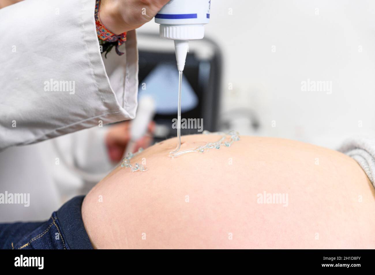 Il medico esegue la procedura ecografica o ecografica per una donna incinta in ospedale, primo piano del trasduttore mobile ostetrista sul ventaglio di Foto Stock