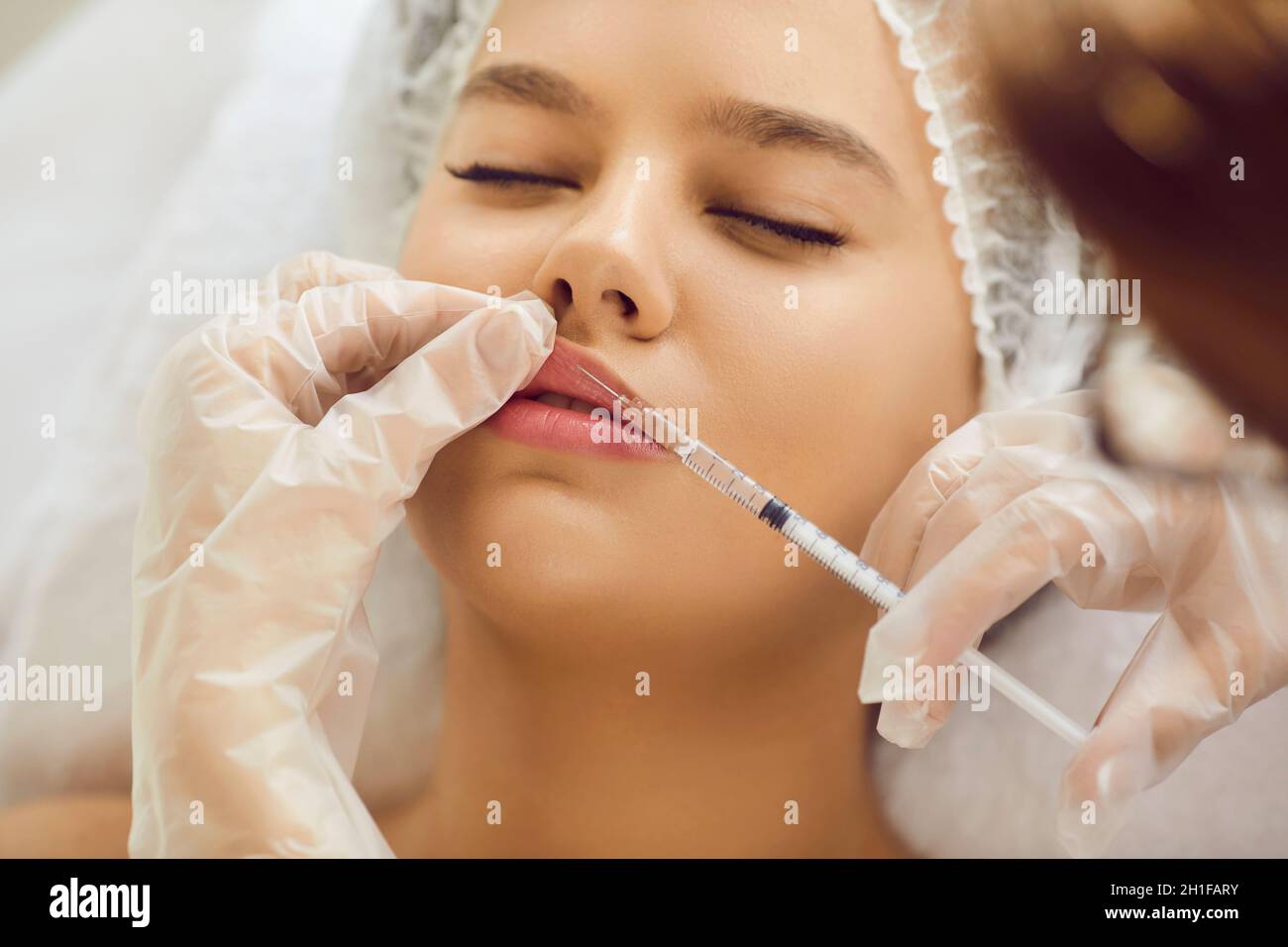 Giovane ragazza che ottiene l'iniezione botox per le labbra più grandi alla clinica della medicina estetica Foto Stock