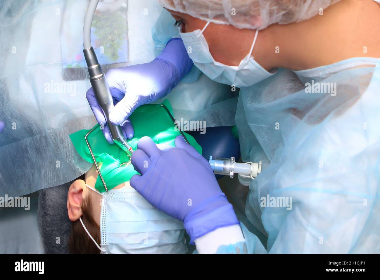 Un chirurgo dentale pediatrico esegue un'operazione per trattare carie profonde in un giovane ragazzo.chirurgia dentale. Concetto di salute e prevenzione.Copia spazio. Foto Stock