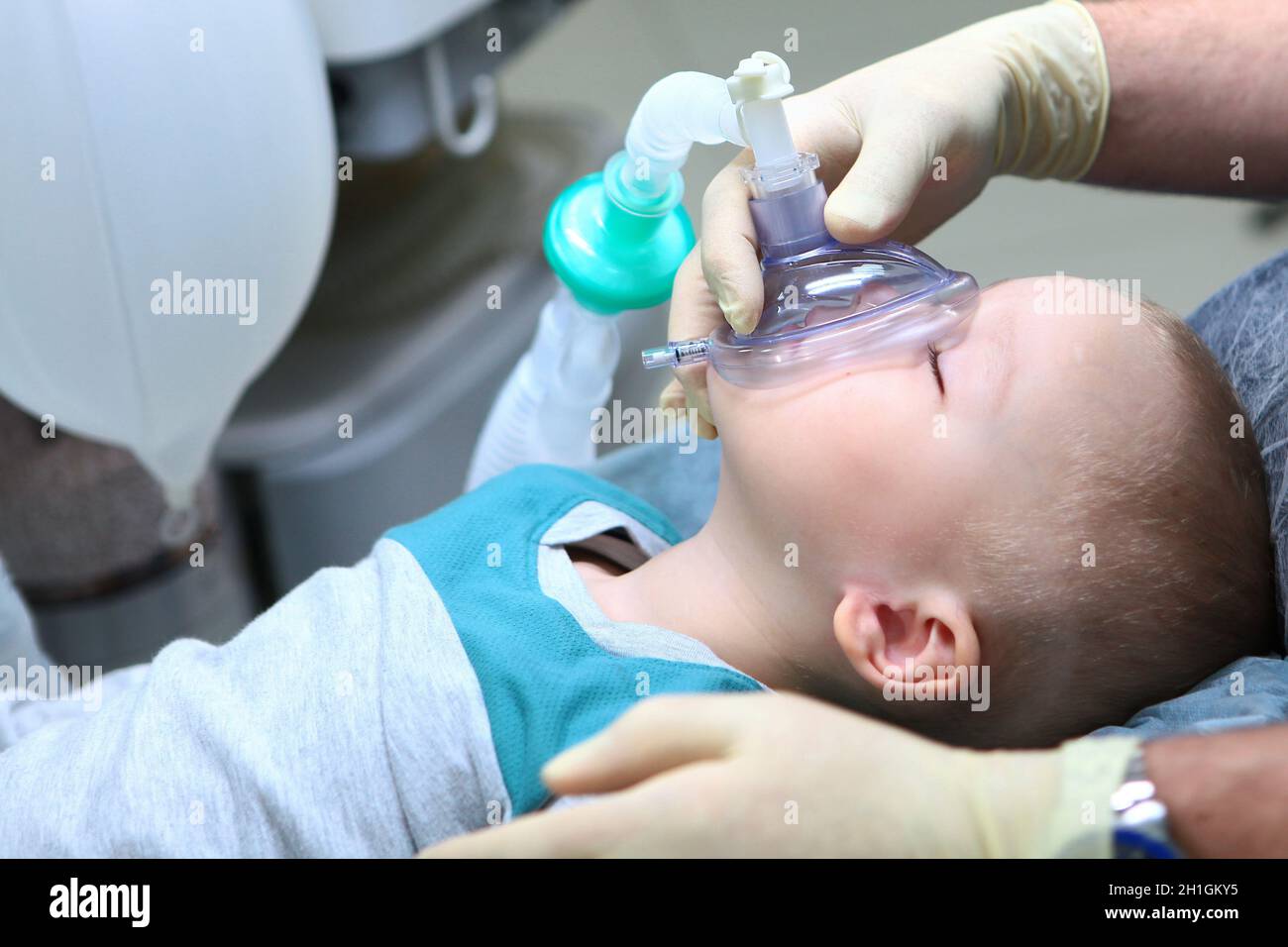 Il bambino è sotto anestesia generale. Trattamento dei denti del bambino.il dispositivo di ventilazione artificiale dei polmoni.spazio di copia. Foto Stock