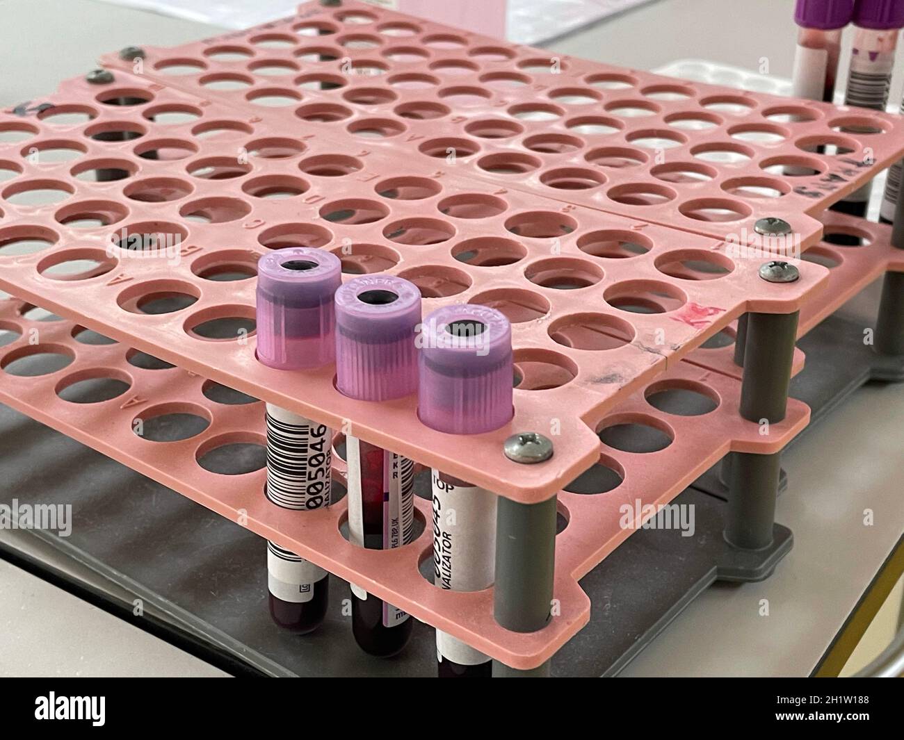 Laboratorio interno, laboratorio di test, campioni di sangue da pazienti con polmonite virale da testare per la presenza di acidi nucleici per SARS-COV-2 e influenza viru Foto Stock