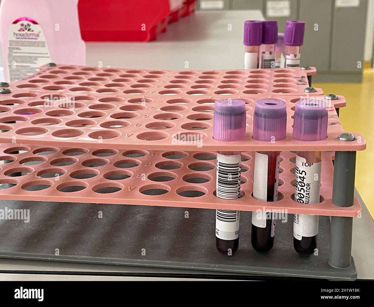 Laboratorio interno, laboratorio di test, campioni di sangue da pazienti con polmonite virale da testare per la presenza di acidi nucleici per SARS-COV-2 e influenza viru Foto Stock