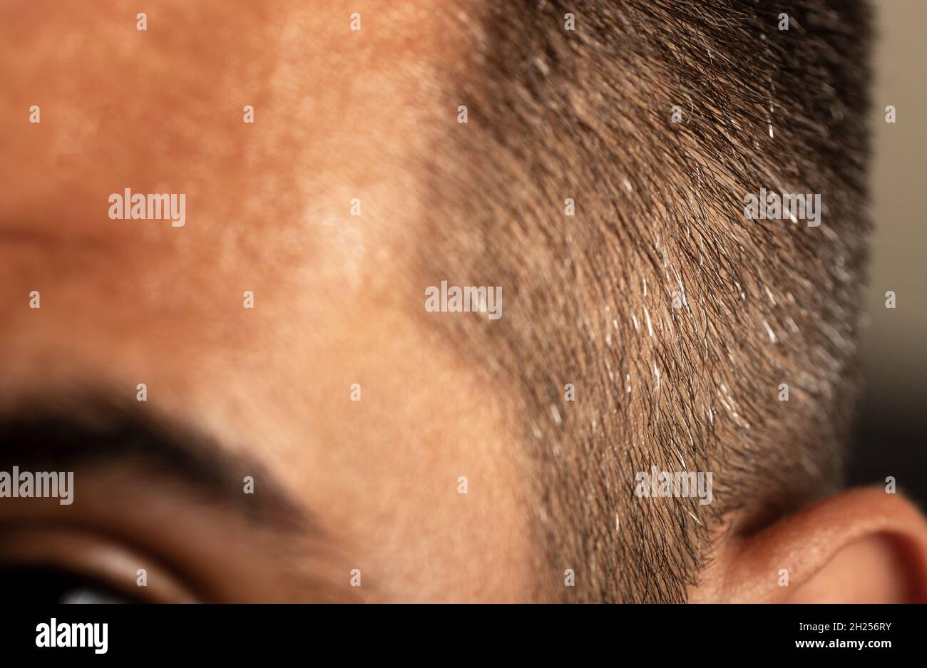 Primo piano di un giovane uomo adulto con capelli grigi lato della testa. Prima età capelli grigio problema concetto. Foto Stock