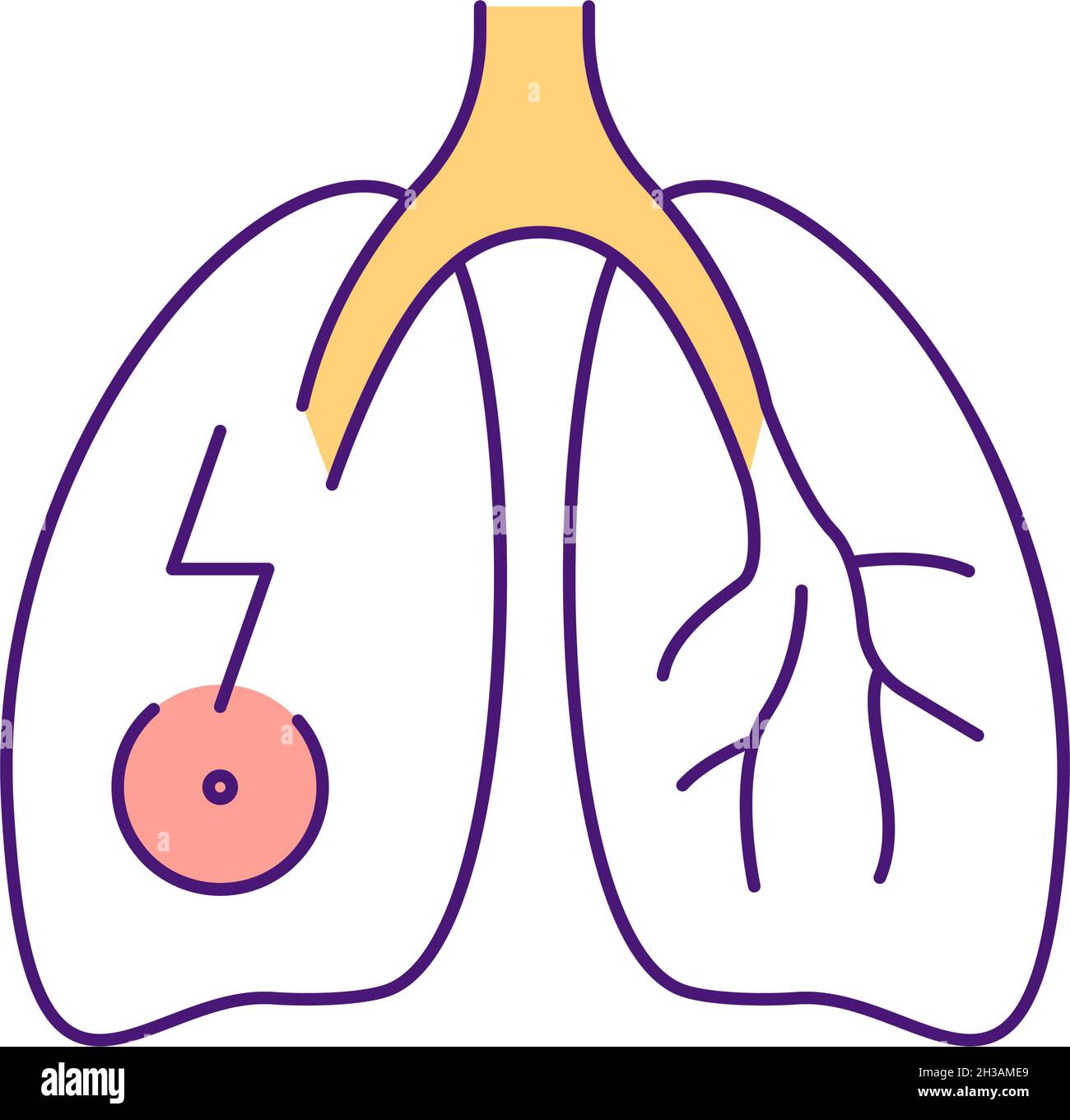 Icona di colore RGB dolore polmonare Illustrazione Vettoriale