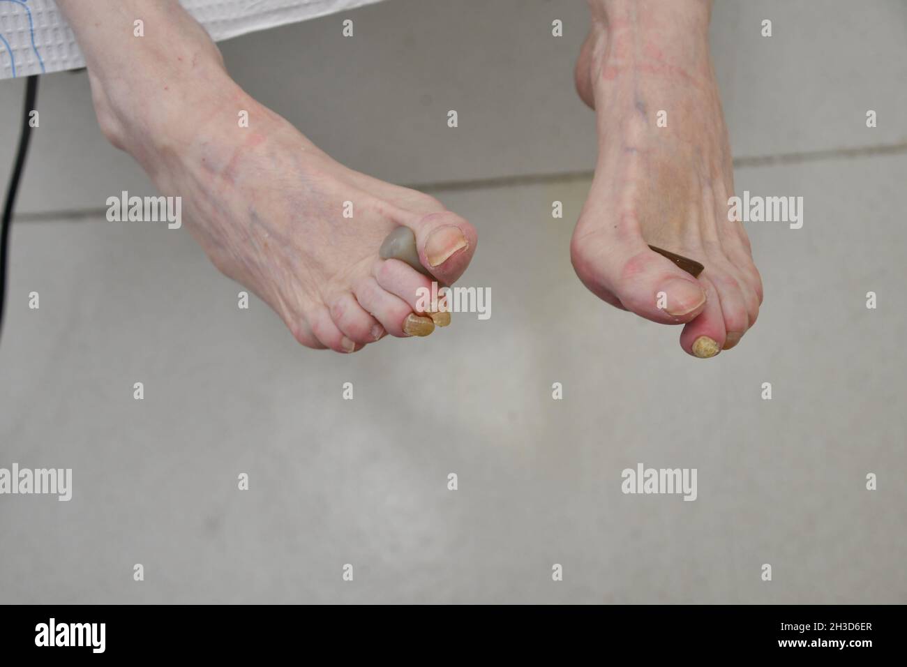 Visita del medico podiatristo geriatrico femminile Foto Stock
