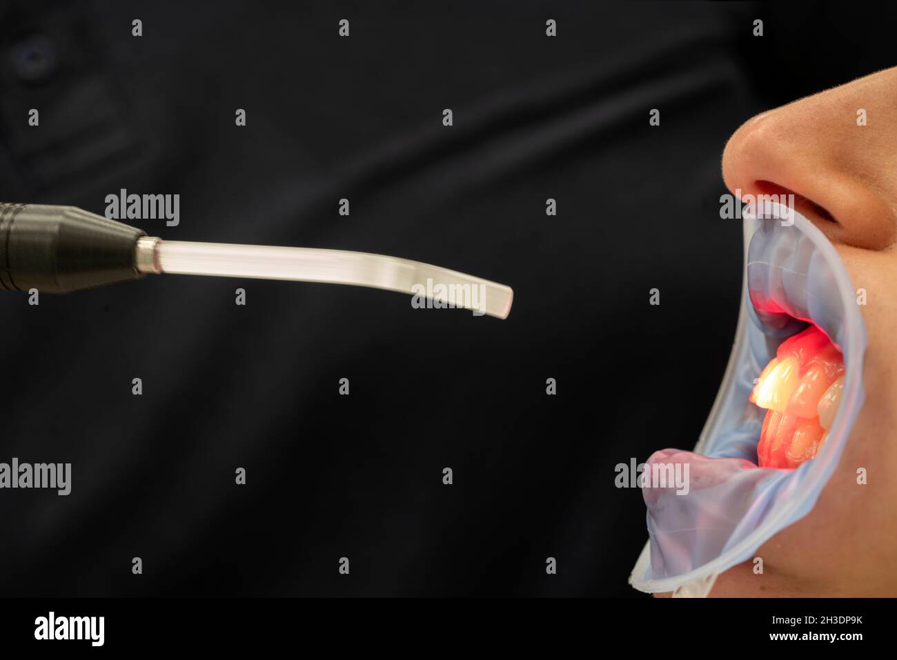 Terapia dentale con luce LED rossa in studio dentale Foto Stock