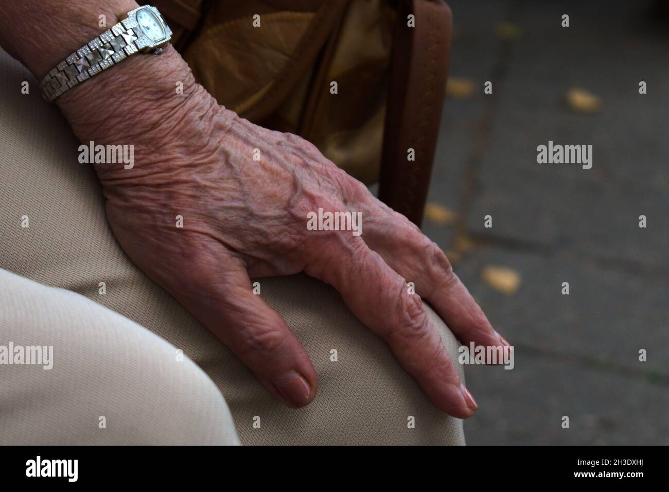 mano donna anziana con un orologio sul ginocchio Foto Stock