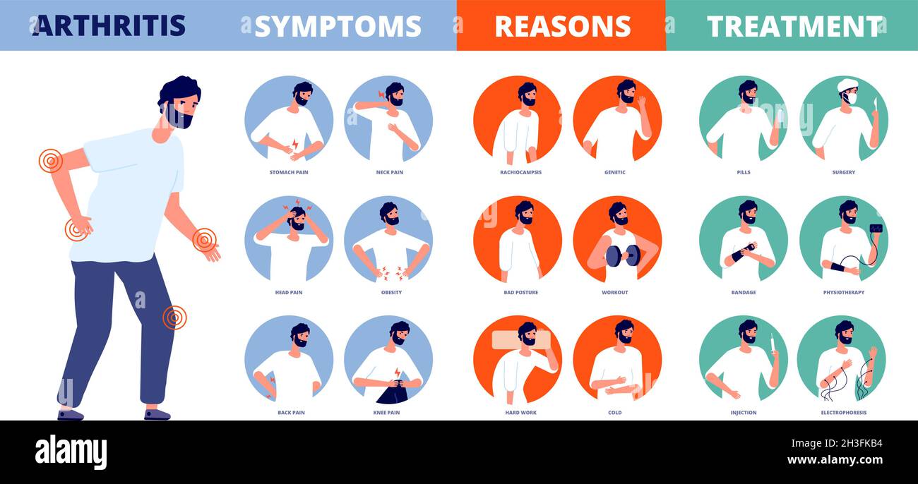 Infografica artrite. Prevenire la malattia reumatoide, deformità delle articolazioni di trattamento. Ossa dolore al ginocchio, osteoartrite sintomi utter vettore medico poster Illustrazione Vettoriale