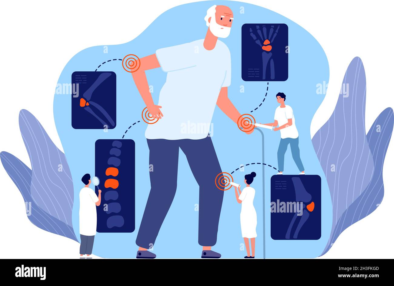 Artrite. Articolazione reumatoide, dolore rotuleo con iniezione. Raggi X delle ossa, rigonfiamento del ginocchio e infiammazione. Concetto del vettore utter della malattia di osteoporosi Illustrazione Vettoriale