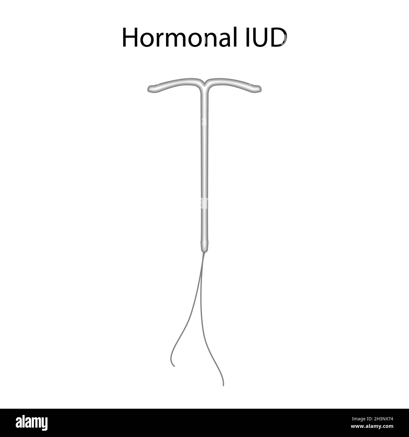 Dispositivi intrauterini ormonali, illustrazione Foto Stock