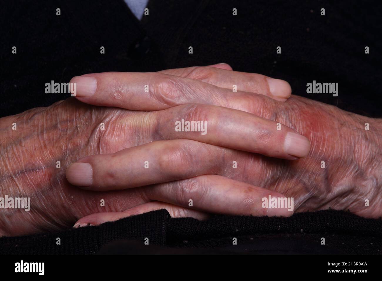 Primo piano sulle mani degli anziani | nonno | bianco | terza età Foto Stock