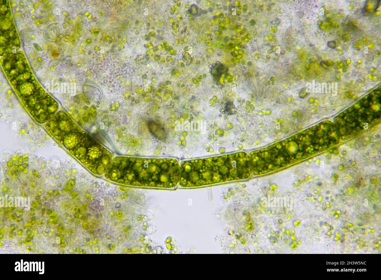Vista microscopica del filamento di alghe verdi tra i detriti. Illuminazione a campo chiaro. Foto Stock