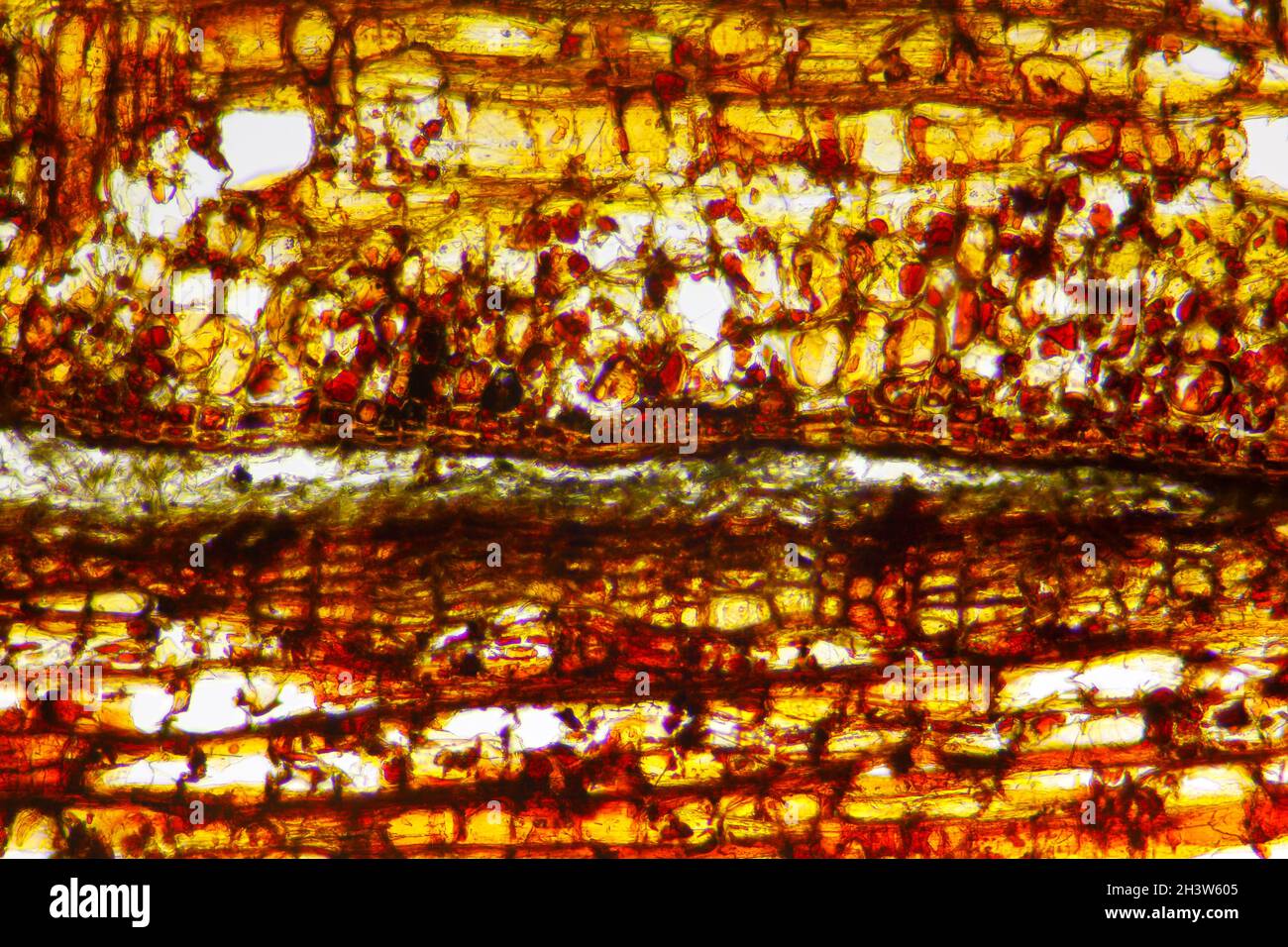 Vista microscopica della sezione di corteccia di pino scozzese (Pinus sylvestris). Illuminazione a campo chiaro. Foto Stock