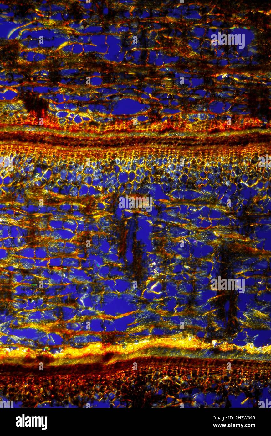 Vista microscopica della sezione di corteccia di pino scozzese (Pinus sylvestris). Luce polarizzata con polarizzatori incrociati. Foto Stock